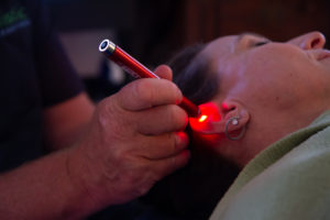laser acupuncture Palm Harbor NY