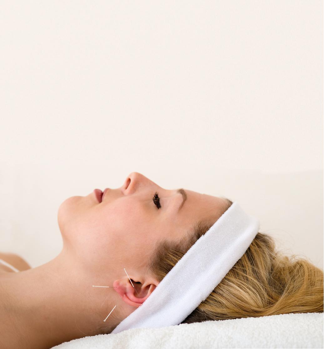 ear acupuncture Tarpon Springs, Florida
