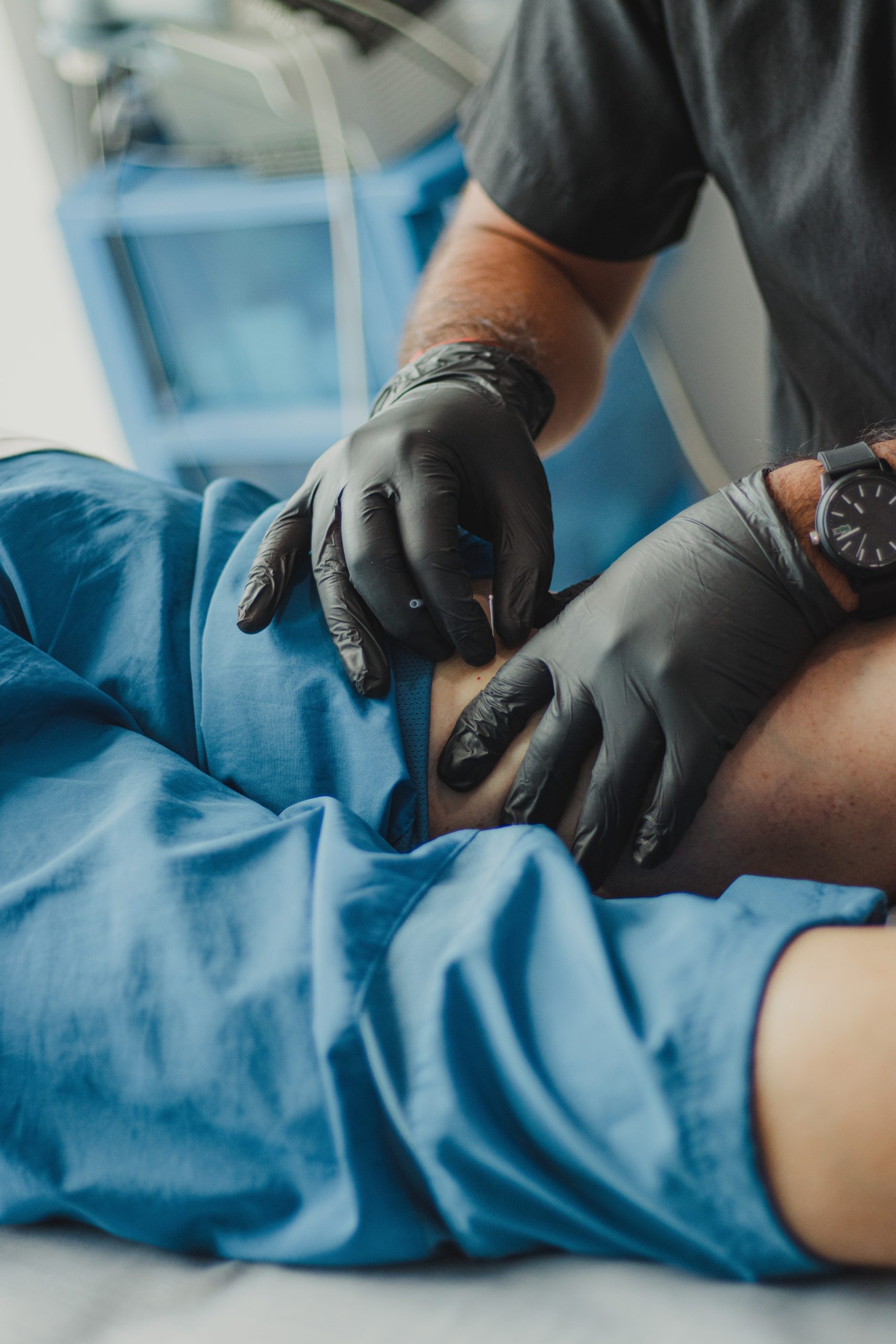 acupuncturist in Palm Harbor, FL